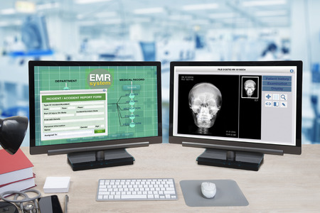 Health information and patient x-ray show on two computer monitors on doctor desk with blue background of hospital office.の写真素材