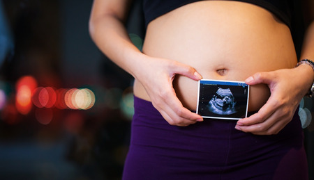 Close up of a cute pregnant bellyの写真素材