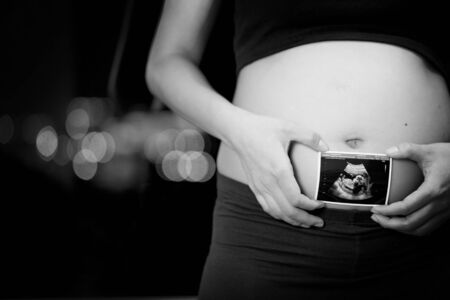 Close up of a cute pregnant bellyの写真素材