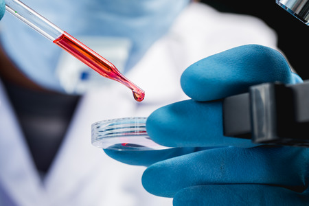 Hands of clinician holding tools during scientific experiment in laboratoryの写真素材