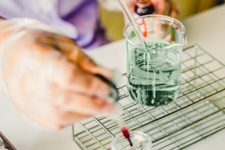 Hands of clinician holding tools during scientific experiment in laboratory,MERSの写真素材