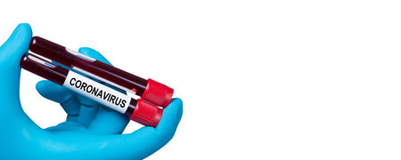 Corona virus outbreaking. Epidemic virus Respiratory Syndrome.