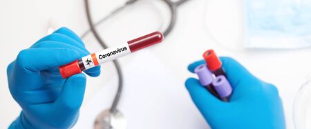 Corona virus outbreaking. Epidemic virus Respiratory Syndrome.の写真素材