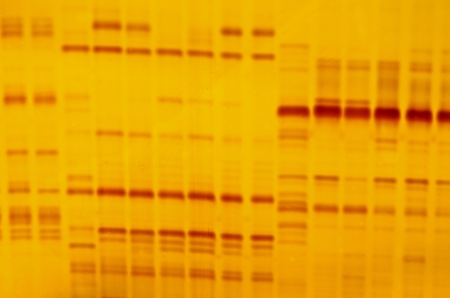 DNA fingerprint with indicator marks and yellow backgroundの写真素材