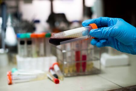 Test tubes closeup on blue background.の写真素材