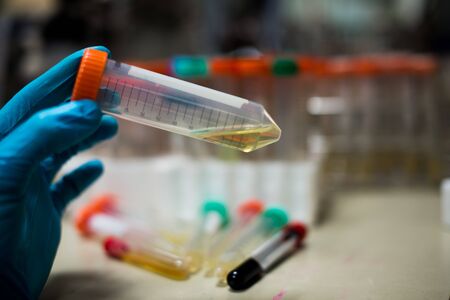 Science laboratory research and development concept. microscope with test tubesの写真素材