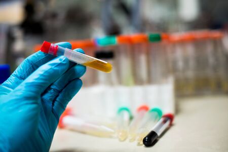 Science laboratory research and development concept. microscope with test tubesの写真素材