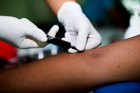 Close up nurse pricking needle syringe in the arm patient drawing blood sample for blood testの写真素材