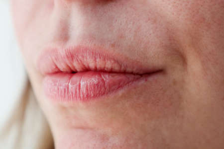Close-up of woman's dry lips and skin with enlarged pores for cosmetic purposesの写真素材
