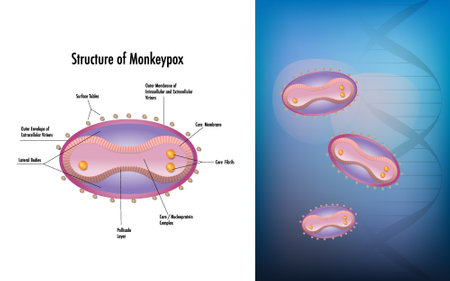Monkeypox is caused by a virusのイラスト素材