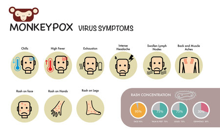 monkeypox virus symptoms pandemic Infographic chartのイラスト素材