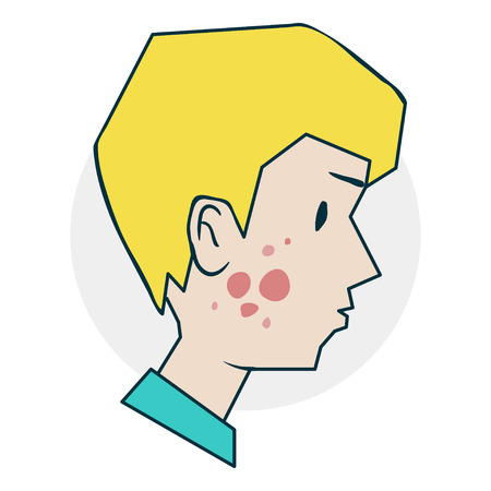 The boy allergies or acneのイラスト素材
