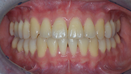 Intraoral photoの写真素材