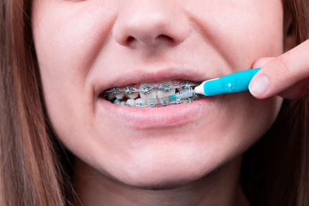 Closeup portrait of teenage girl using bristle brush for cleaning braces and teethの写真素材