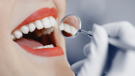 Dentist. Smiling pretty woman is having her teeth examined by dentist in clinic. Concept of caries treatment in dentistryの写真素材