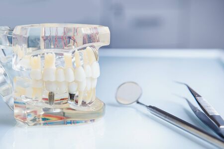 Stomatology. Plug-in glass jaw mock-up for training students of dentists, dentists. Tool.の写真素材