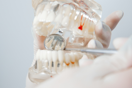 Jaw breadboard. Orthodontist holds jaw in his hands for training. Package with capillaries, roots, pins.の写真素材
