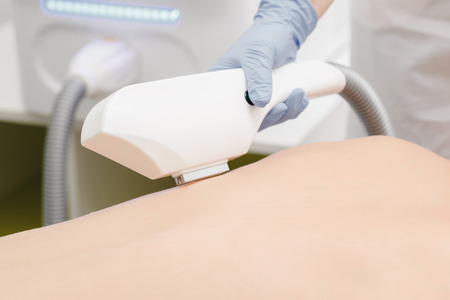 Device for laser hair removal. Epilation, depilation any zone of men and women in process close-upの写真素材