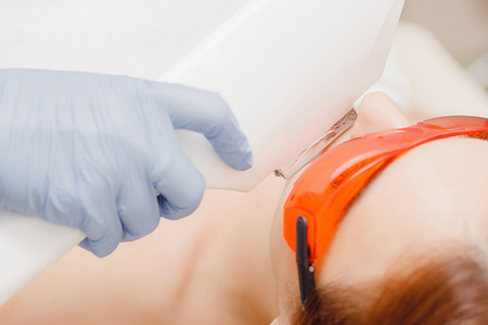 Master carries out procedure of laser hair removal mustache on face young girl. Health and care conceptの写真素材