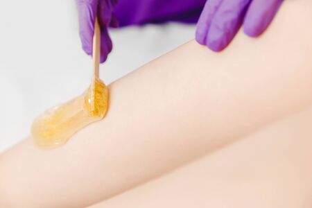 Hair removal concept. Application of sugar paste for shugaring depilation on skin of girl legsの写真素材