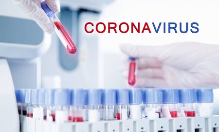 Banner coronavirus 2019-ncov microbiologist blood test, blurred backgroundの写真素材