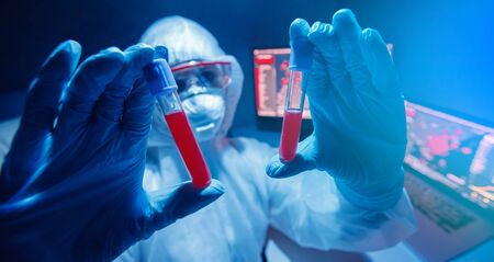 Secret scientist danger biological laboratory analyzes virus strain model of MERS-Cov coronavirus 2019-nCoV. Blue backgroundの写真素材