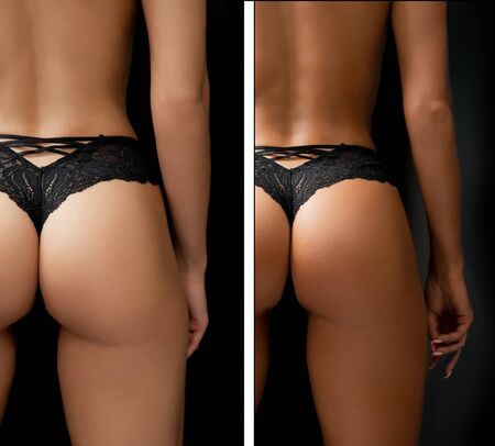 Woman before after instant tan spray skintone bodyの写真素材
