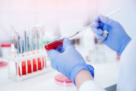 Nurse microbiologist holding test tube with blood for coronavirus 2019-nCoV analyzingの写真素材