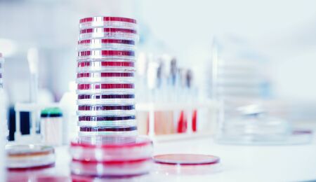 Microbiology laboratory agar plate full of micro bacterias and microorganisms E. coli grow biological samplesの写真素材