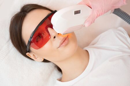 Removal of unwanted hair laser Epilation on face mustache young woman. Concept beauty and healthの写真素材