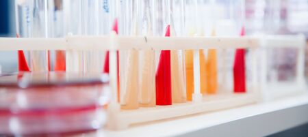 Microbiology laboratory yeast cultivation on agar medium plate, white background.の写真素材