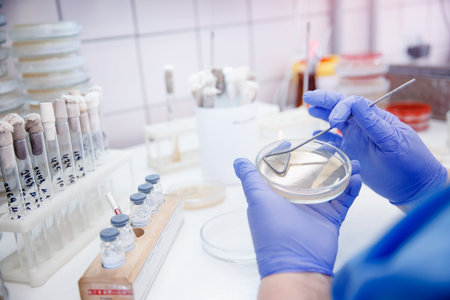 Microbiology hand medical working on agar plate culture bacteria and drug resistance of pathogens in...
