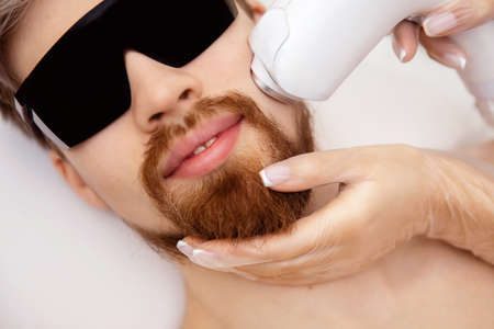 Closeup procedure man face laser epilation hair mustache and beardの写真素材