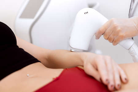 Arm laser hair removal treatment, body care woman. Concept health and beautyの写真素材