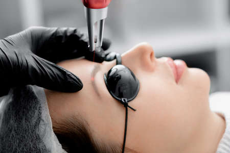 Laser removal of permanent makeup eyebrow of young woman in salonの写真素材