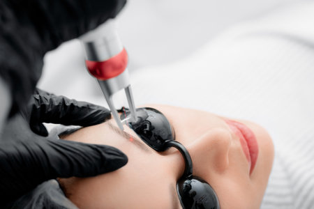 Laser removal of permanent makeup eyebrow correction of young woman in salonの写真素材