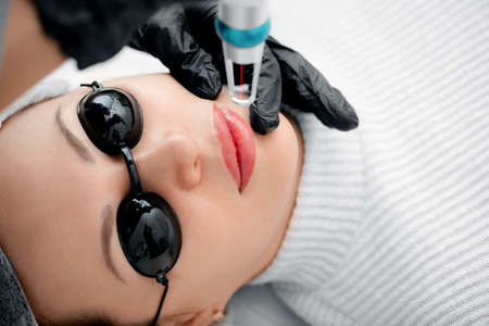 Laser removal of permanent make-up on face lips of young woman in salonの写真素材