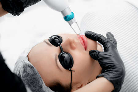 Laser removal of permanent make-up on face lips of young woman in salonの写真素材