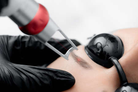 Laser removal of permanent make-up on face of young woman. Correction tattoo eyebrow in salonの写真素材