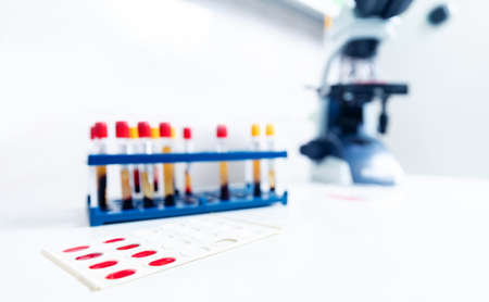 Macro photo analyzing blood in tube background microscope at laboratory , banner white light blue color toningの写真素材
