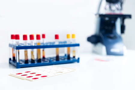 Macro tube with analyzing blood, microscope at laboratory , banner white light blue color toningの写真素材
