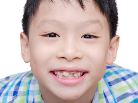 Happy Asian boy toothless smile close-up,new teeth rising over white backgroundの写真素材
