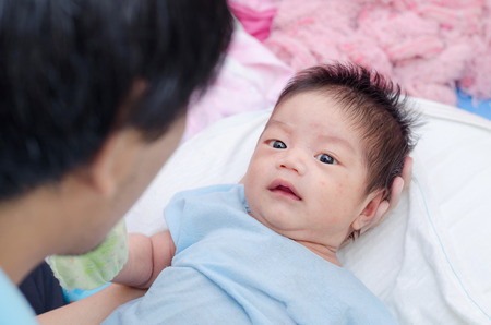 Little asian newborn with many rash on faceの写真素材