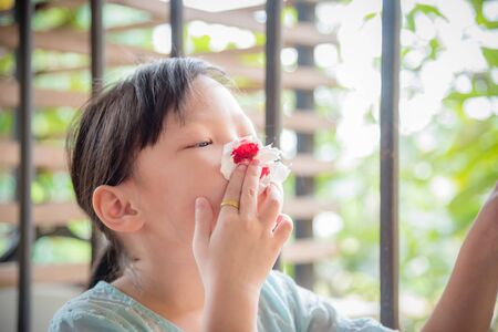 Little asian girl wipe her bleeding nose by tissue paperの写真素材