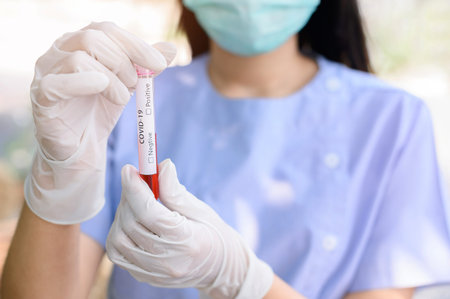 Nursing hold blood tube COVID-19. Blur Nurses wearing masks and gloves To prevent communicable...