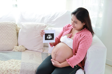 Happy smiling young asian pregnant woman resting and sitting on sofa in living room while showing ultrasound image. Expectant mother preparing and waiting for baby birth during pregnancy.の写真素材