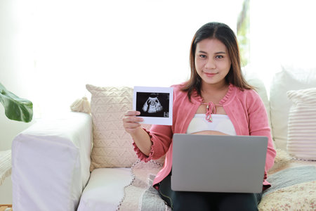 Happy smiling young asian pregnant woman resting and sitting on sofa in living room while showing ultrasound image with computer. Expectant mother preparing and waiting for baby birth during pregnancyの写真素材