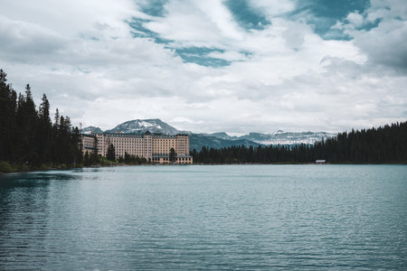 Lake Louise, Banff National Park, Alberta, Canada in a summer day. Lake Louise and its hotel, Banff National Park, Alberta, Canada.の写真素材