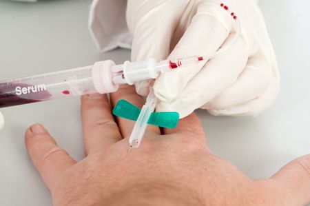 Young doctor with a blood sampleの写真素材