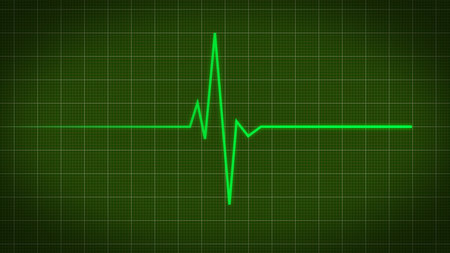 Heart rate monitor on green background. 2d illustrationの写真素材